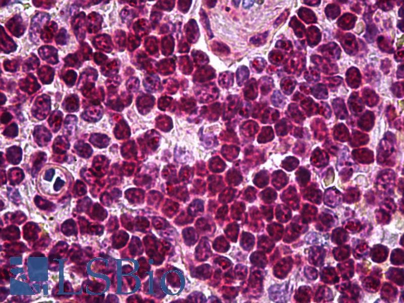 IHC-plus™ SOX10 Antibody (clone 1E6)