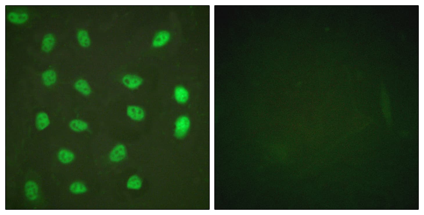 MEF2A / MEF2 Antibody (phospho-Ser408)