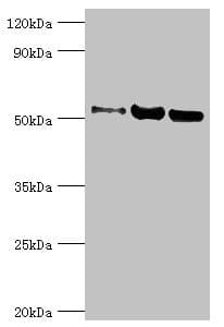 Polyclonal Rabbit anti-Human G3BP1 / G3BP Antibody (aa227-466, IHC, WB)
