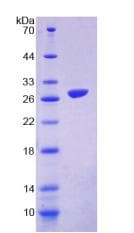 Mouse SIRPB1 / CD172b Protein (Recombinant His-T7)