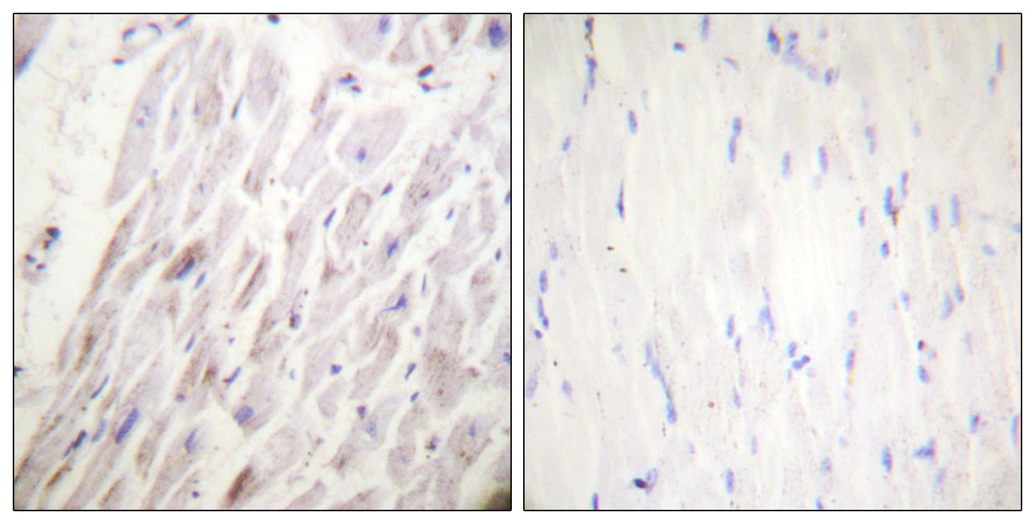Polyclonal Rabbit anti-Human DMTN / Dematin Antibody (phospho-Ser403, IHC, WB)