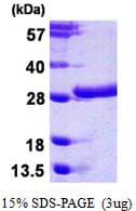 Human CSN2 / Beta Casein Protein (Recombinant His)