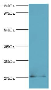 Polyclonal Rabbit anti-Human PRND / DOPPEL Antibody (aa20-160, IHC, WB)
