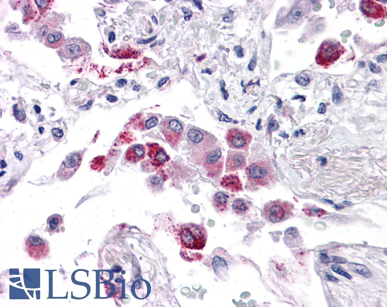 IHC-plus™ EFHD1 Antibody
