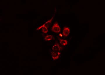 Polyclonal Rabbit anti-Human ZFYVE19 Antibody (IHC, IF, WB)