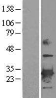 Human PRDX6 / Peroxiredoxin 6 Protein (Over-Expression Lysate Myc-DDK (Flag))