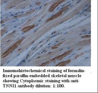 TNNI1 Antibody