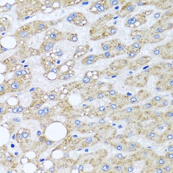 SRI / Sorcin Antibody