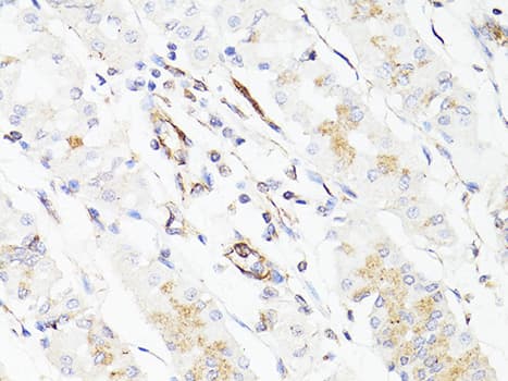 Vimentin Antibody