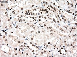 TYRO3 Antibody (clone OTI2C4)