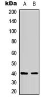 Polyclonal Rabbit anti-Human B1R / BDKRB1 Antibody (Internal, IF, WB)