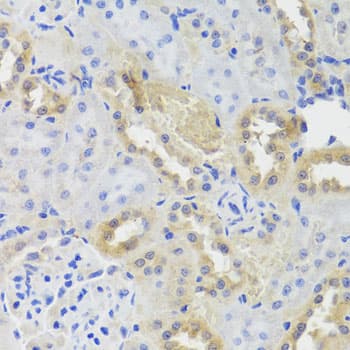 CTSC / Cathepsin C / JP Antibody