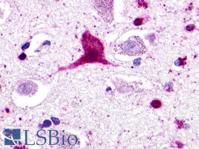 PathPlus™ GPR62 Antibody (Cytoplasmic Domain)