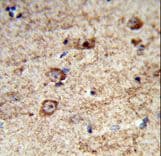 LRRC4 Antibody (aa531-559)