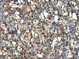 PFKP Antibody (clone OTI2E8, Carrier-free)