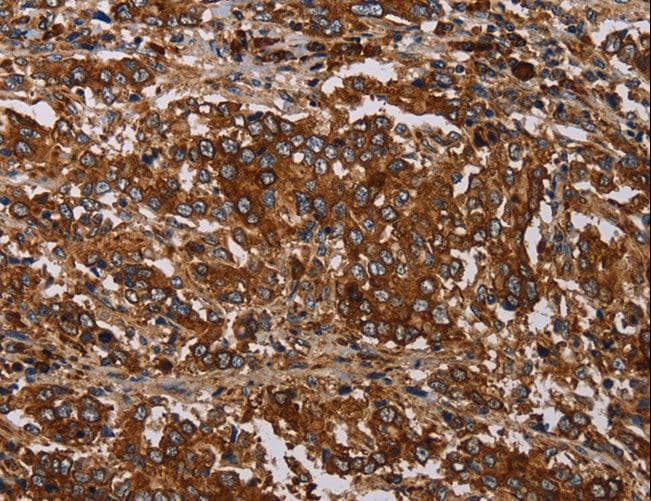 MAGEC2 / CT10 Antibody