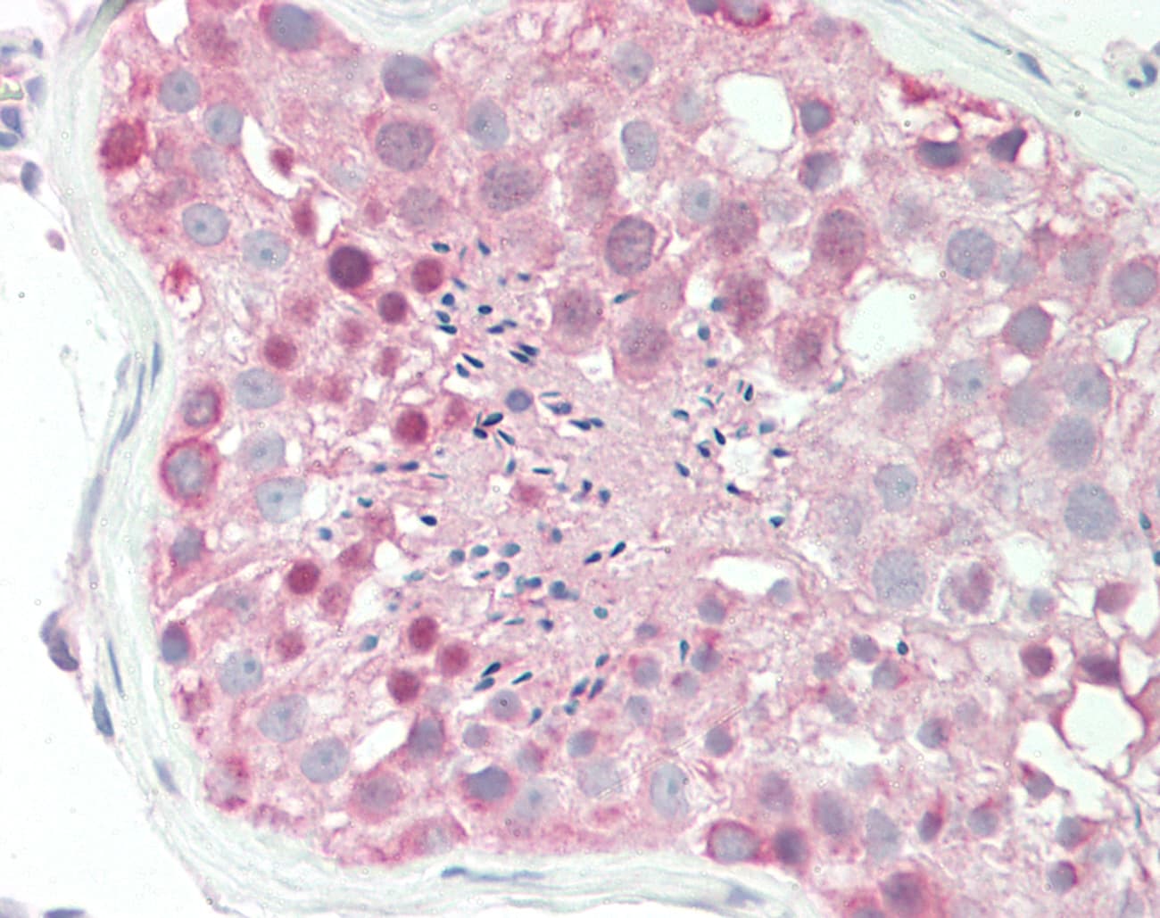 CSNK1G2 / CKI-Gamma 2 Antibody (C-Terminus)