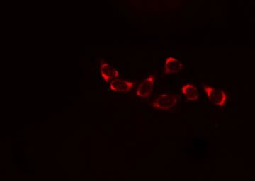 Polyclonal Rabbit anti-Human PLA2G4A Antibody (IHC, IF, WB)