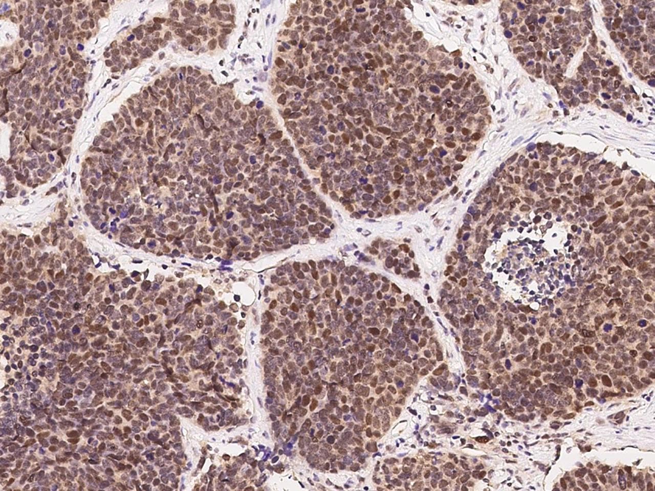 Polyclonal Rabbit anti-Human PTGES3 / p23 Antibody (Preservative Free, IHC)