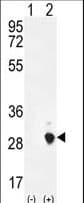 Placental Lactogen Antibody (aa177-204)