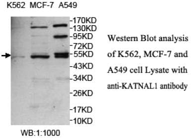 Polyclonal Rabbit anti-Human KATNAL1 Antibody (aa2-168, IHC, WB)