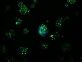 APP / Beta Amyloid Precursor Antibody (clone OTI7G9)