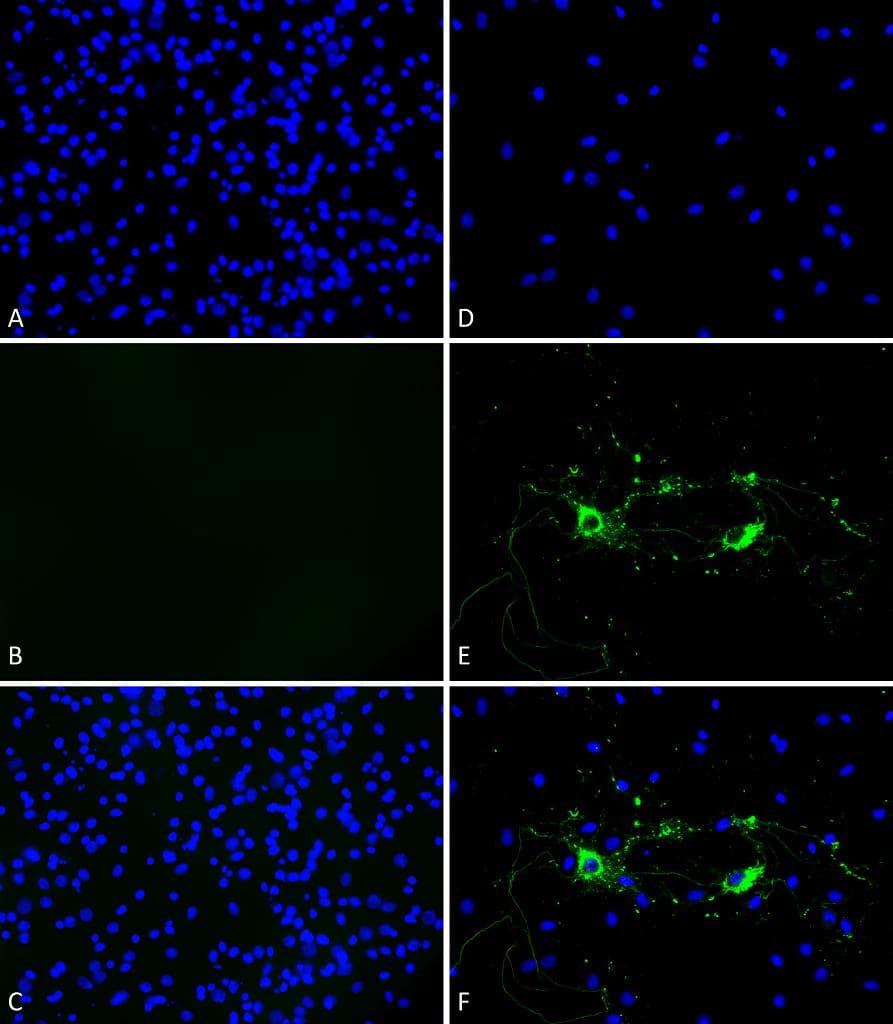 Mouse SNCA / Alpha-Synuclein Protein (Recombinant)
