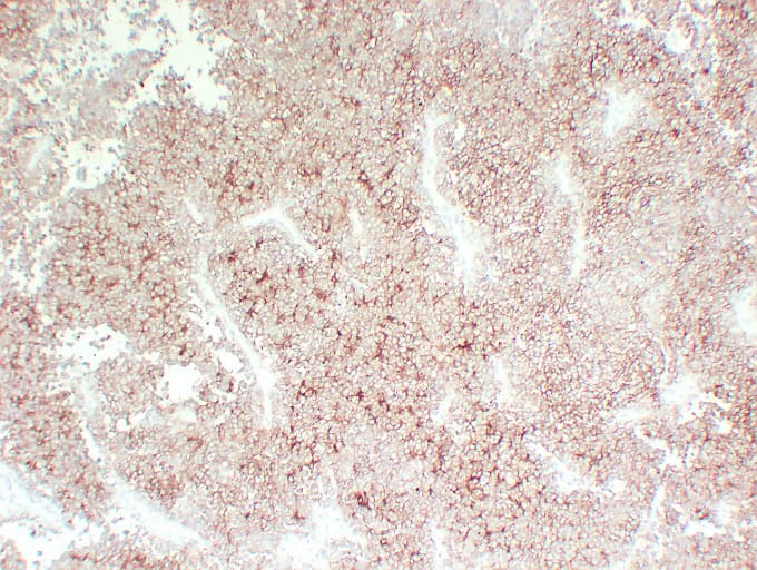 Monoclonal Mouse anti-Human CD99 Antibody (clone ABT-CD99, IHC)