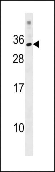 Polyclonal Rabbit anti-Human KRBOX1 Antibody (aa94-120, WB)