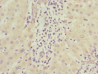 Polyclonal Rabbit anti-Human ICAM4 / CD242 Antibody (IHC, WB)