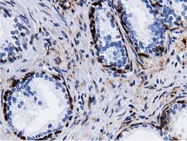 QPRT Antibody (clone OTI7A8)