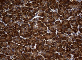 NME1 / NM23 Antibody (clone OTI2H10)
