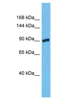VEPH1 Antibody (aa739-788)