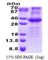 Human NEURL2 Protein (Recombinant His)