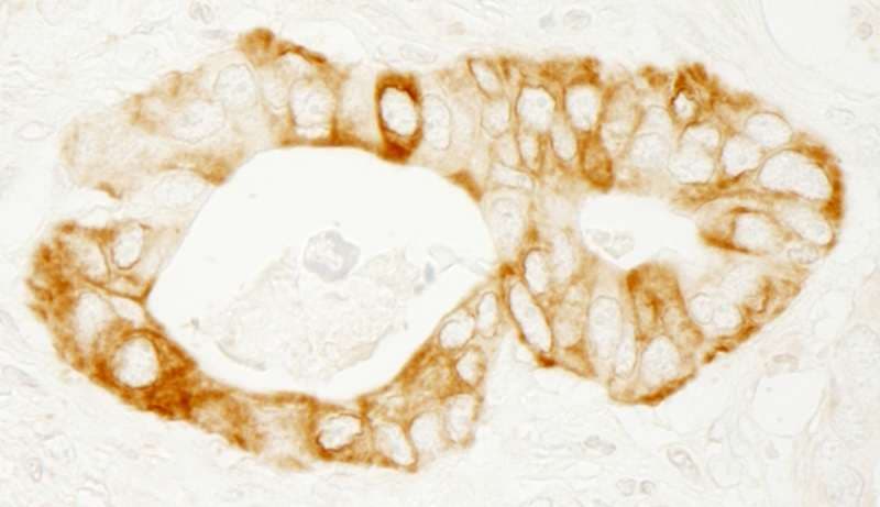PRKD2 / PKD2 Antibody (aa825-C-term)