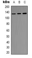 Polyclonal Rabbit anti-Human FAK / Focal Adhesion Kinase Antibody (C-Terminus, IHC, IF, WB)