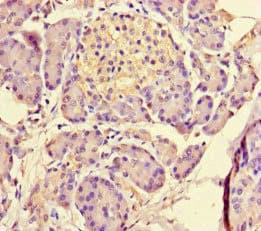 MED31 Antibody