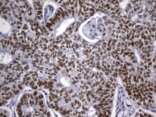 MSH2 Antibody (aa1-304, clone UMAB259)