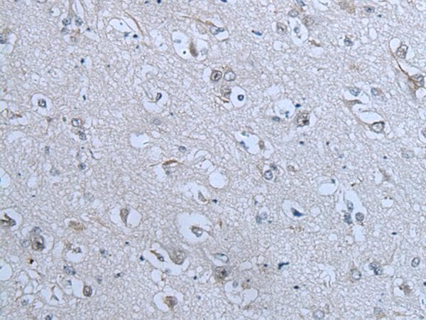 Polyclonal Rabbit anti-Human ZNF703 Antibody (IHC)