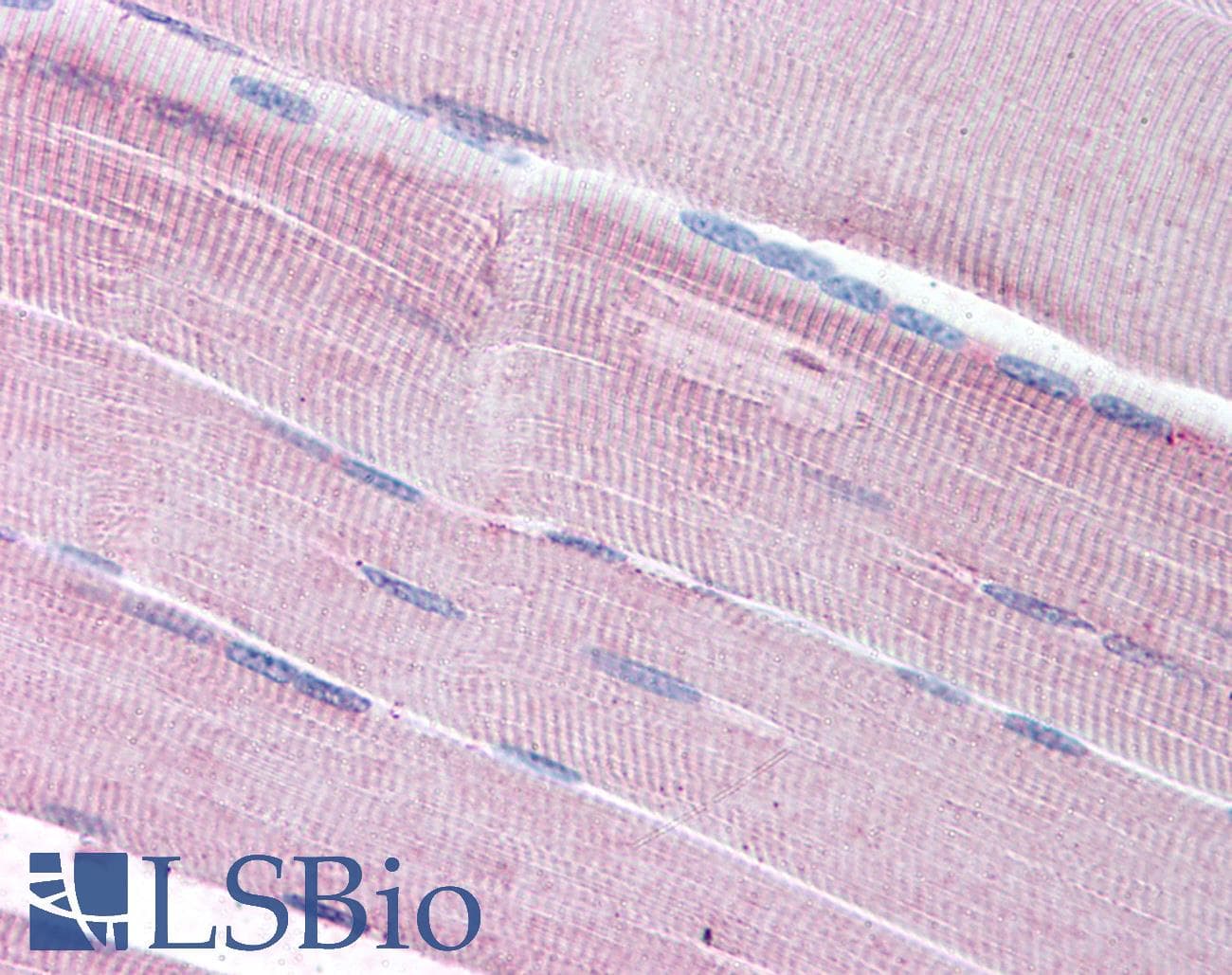 IHC-plus™ Polyclonal Goat anti-Human SORBS1 / Ponsin Antibody (aa449-462, IHC)