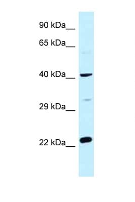 CCDC68 Antibody (aa121-170)