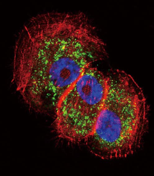 PARK2 / Parkin 2 Antibody (aa387-417)