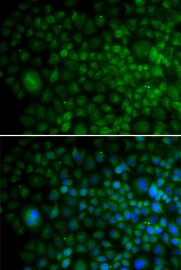 IHC-plus™ Angiogenin / ANG Antibody