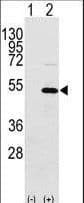 YBX1 / YB1 Antibody (aa276-305)