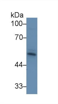 ACVR2 / ACVR2A Antibody (aa192-325, APC)