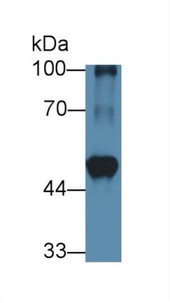 BCAT1 / ECA39 Antibody (PE)