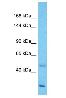 Polyclonal Rabbit anti-Human ZNF138 Antibody (aa231-280, WB)
