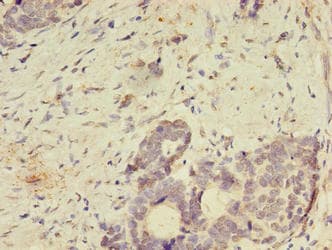 Polyclonal Rabbit anti-Human SPIRE2 Antibody (aa79-388, IHC)