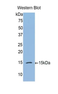 CFB / Complement Factor B Antibody (aa270-388)