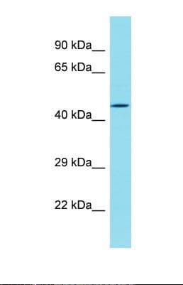 Polyclonal Rabbit anti-Human DBF4B / DRF1 Antibody (N-Terminus, WB)